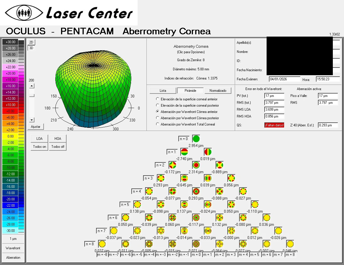 Aberrometría corneal del ojo derecho antes del CAIRS